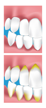 Dentiste Montrouge 92 parodontie